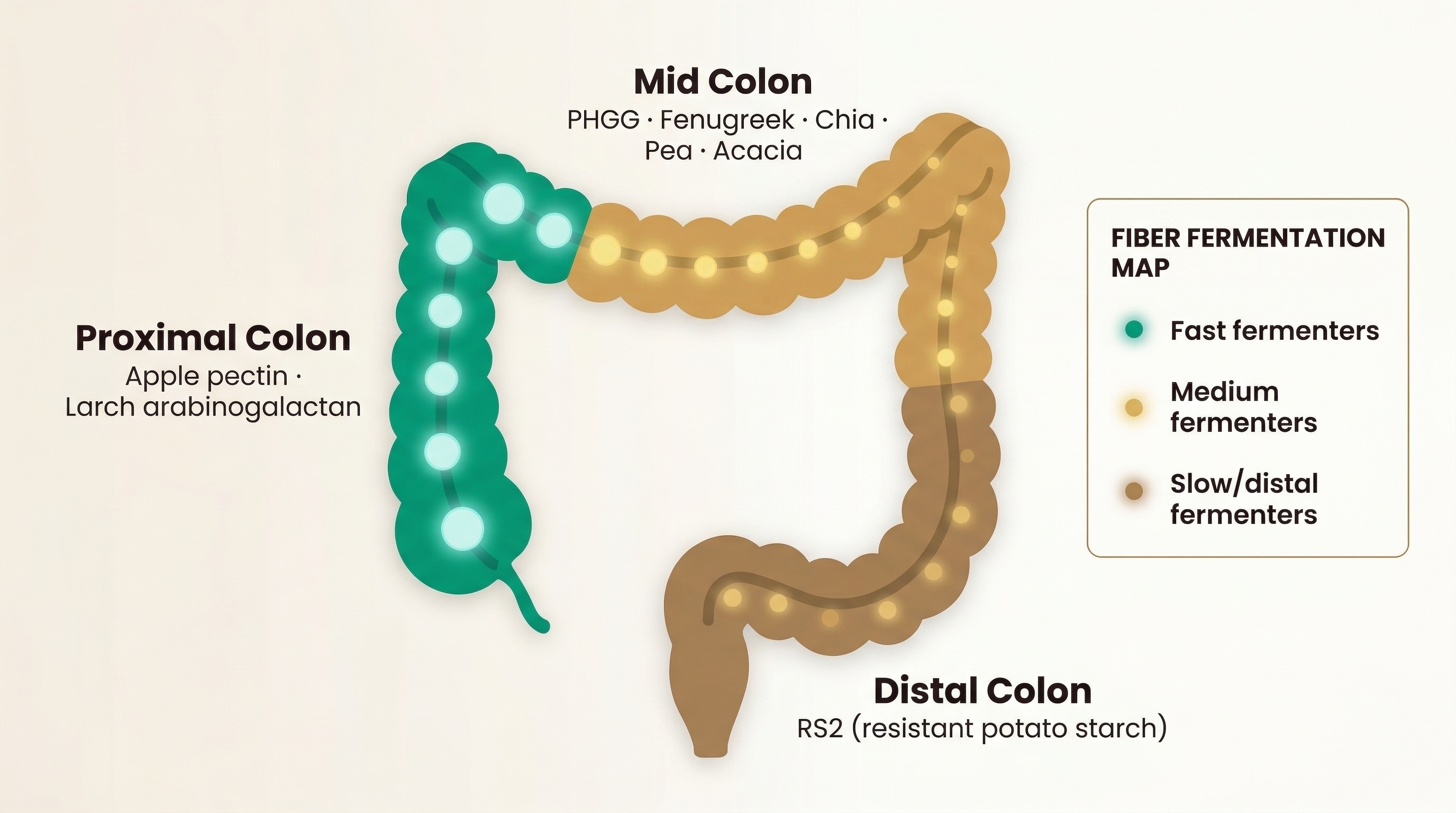 Diagram of fiber fermentation along the colon, highlighting gas build-up points