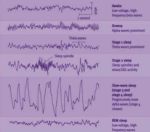 Sleep Stages Diagram